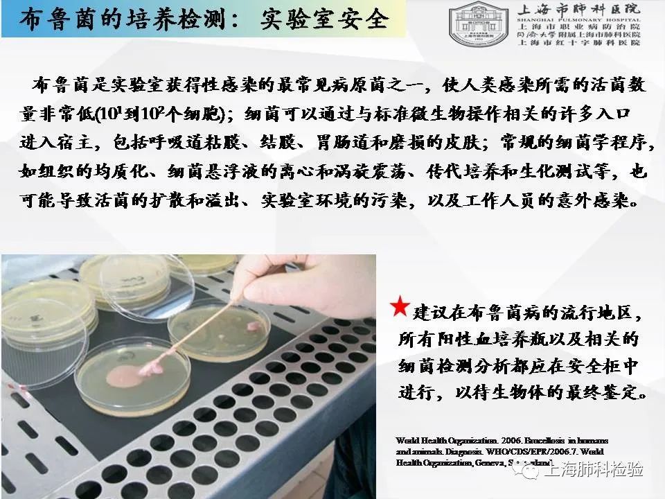 【上海肺科检验】布鲁菌病的实验室诊断