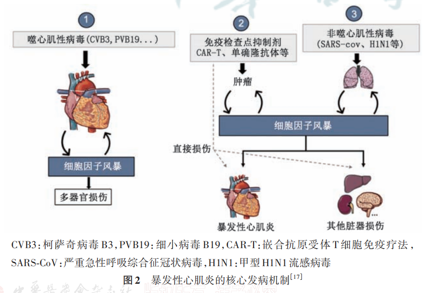 警惕！这种感冒可能是致命的爆发性心肌炎，专家提醒...